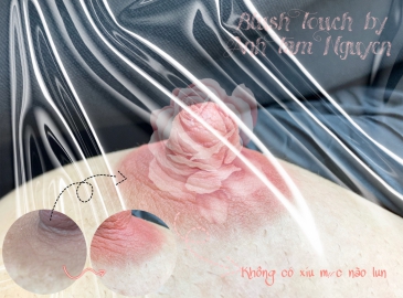 NGUYÊN NHÂN NHŨ HOA THÂM